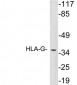 HLA-G Antibody (aa45-94)